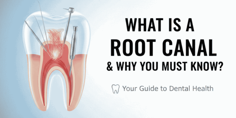What is a Root Canal and When Do You Need One